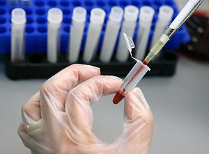 ВИЧ настигает взрослых и беременных