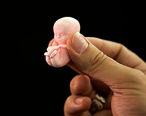 Дело о мертвых младенцах