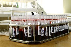 Искусственная кровь как шанс на будущее