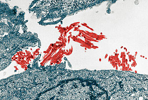 Грипп, сложнее и тяжелее