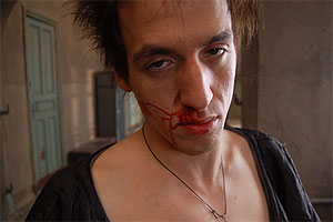 "Сколько сотрясений мозга у вас было?"