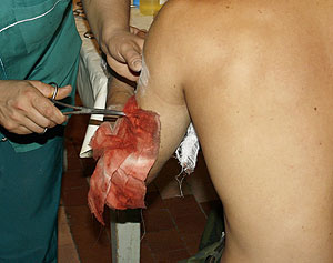 Окровавленная одежда и следы перевязки