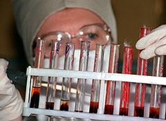 Те, кто утверждают, что в России не борются со СПИДом, лгут