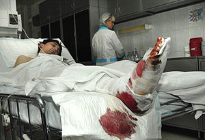 "Домодедово": пострадавших все больше