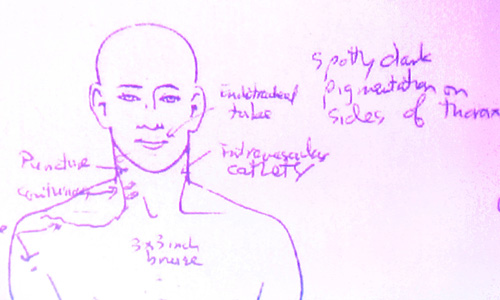 Майкл Джексон не мог сам сделать укол обезболивающего, который стал причиной его смерти, заявил в среду на суде доктор Кристофер Роджерс, проводивший посмертное вскрытие певца. По его мнению, скорее всего, укол с избыточным количеством пропофола сделал врач Джексона Конрад Мюррей.