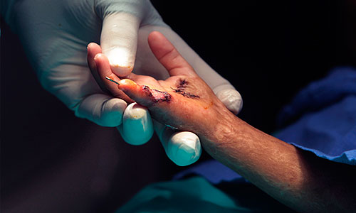 Работа врачей никарагуанской Ассоциации помощи детям, пострадавшим от ожогов.