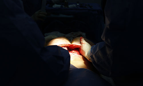 Исправление последствий нелегальных пластических операций в Венесуэле.