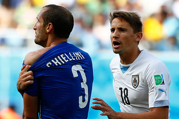 Укушенное Суаресом плечо с другого ракурса.