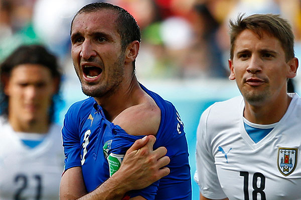 Кьеллини продолжает показывать плечо.