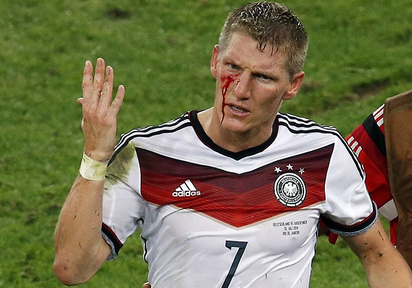 Полузащитник сборной Германии Бастиан Швайнштайгер получил рассечение по ходу финального матча.