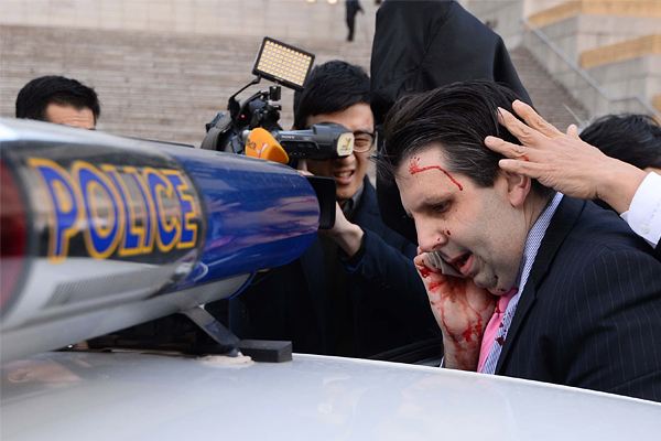 Посол США в Южной Корее Марк Липперт после нападения