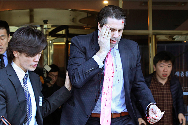 Посол США в Южной Корее Марк Липперт после нападения