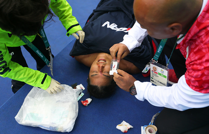 Японская спортсменка Кения Ясуда получила травму в предварительном матче по водному поло