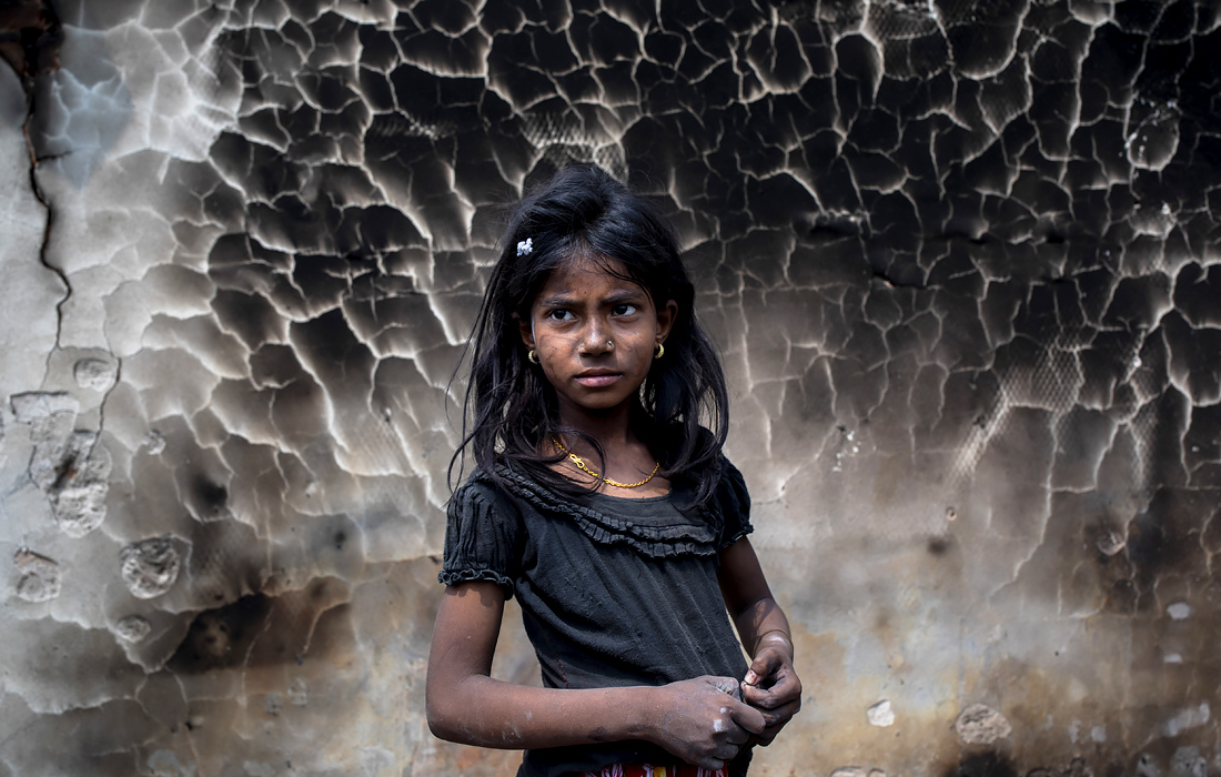 Девочка в лагере беженцев Балухали, Бангладеш