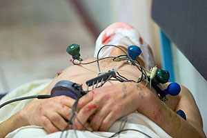 Особенности отравления метанолом