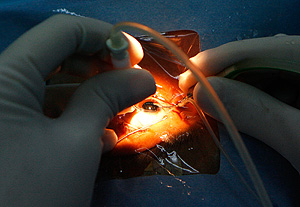 В "Микрохирургии глаза" новый глава