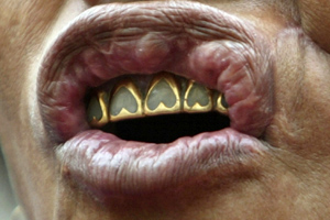 Золото-2011: трудный год