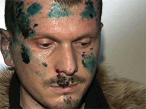 Экстрадиция в деле о покушении