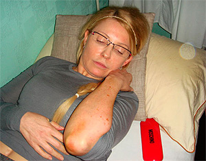 Тимошенко в клинике