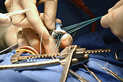 СКР хочет наказать убийцу кардиохирурга