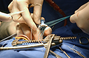 СКР хочет наказать убийцу кардиохирурга