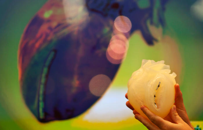 Минздрав предложил возмещать часть стоимости лекарств после операций на сосудах