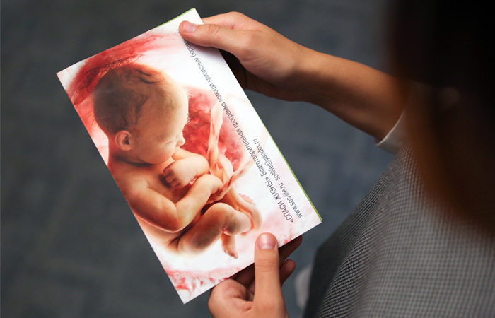 Против исключения абортов из системы ОМС высказались 70% россиян