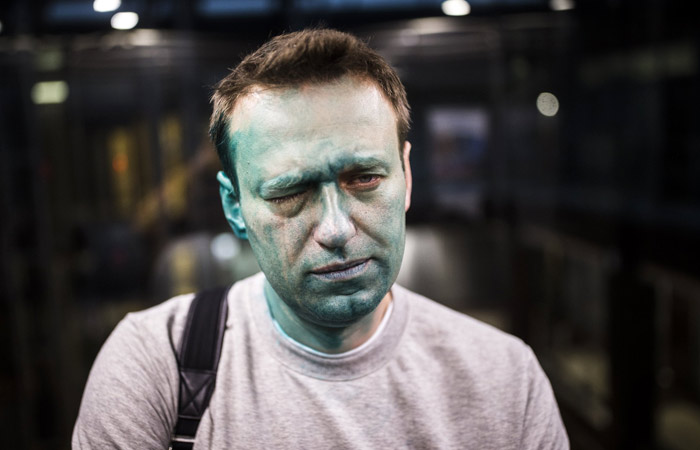 Навальный заявил об утрате 80% зрения одним глазом после нападения с зеленкой
