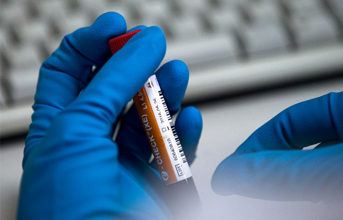 СКР обвинил Родченкова в подмене результатов допинг-проб российских спортсменов