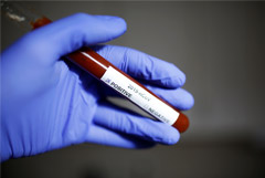 Коронавирус добрался до Эстонии