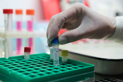 Роспотребнадзор анонсировал надомное тестирование на коронавирус в Москве и области