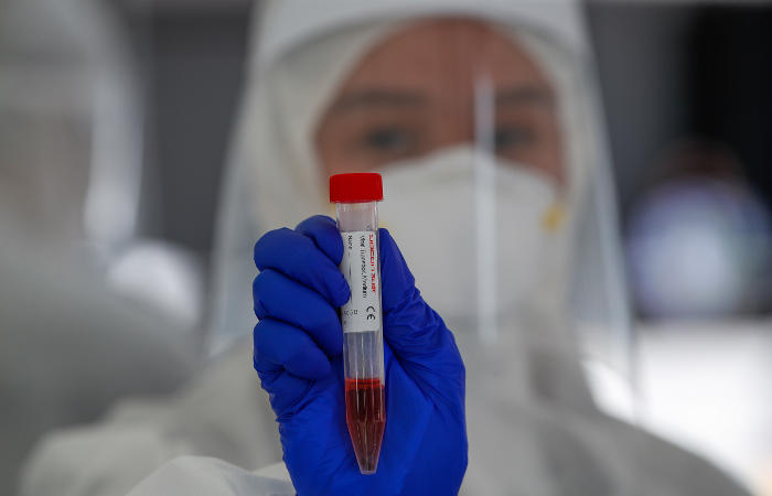 Число жертв коронавируса в мире превысило 233 тысячи человек