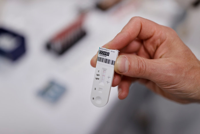 Университет Хопкинса оценил число инфицированных в 3,9 млн человек