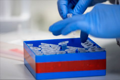 В Томской области выявили редкий хантавирус, вызывающий геморрагическую лихорадку