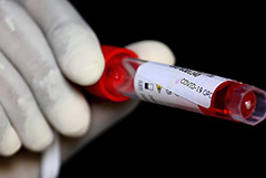 У двух представителей ФК ЦСКА заподозрен коронавирус