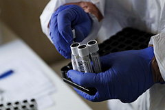 Карелия заняла первое место в стране по заболеваемости COVID за сутки