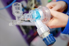 Более 75% пациентов с коронавирусом на ИВЛ в России умерли