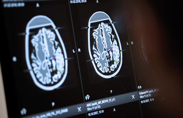 Пожарный подъемник снял с колоннады Исаакиевского собора женщину, которой стало плохо