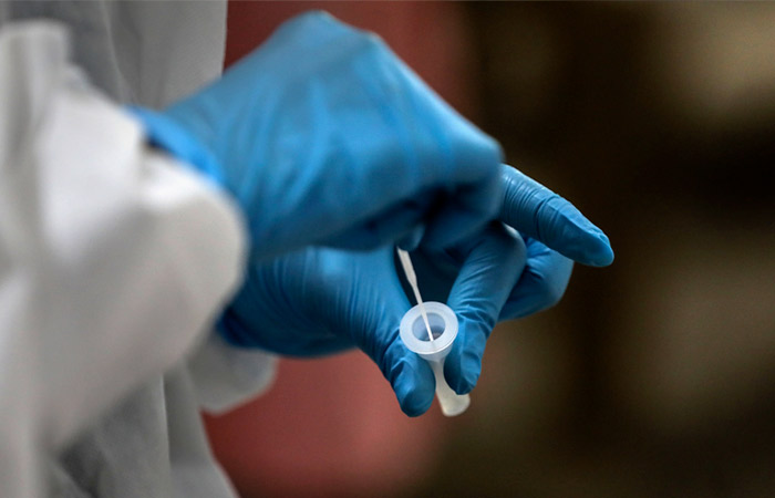 В России за сутки умерли 1 163 пациента с COVID-19