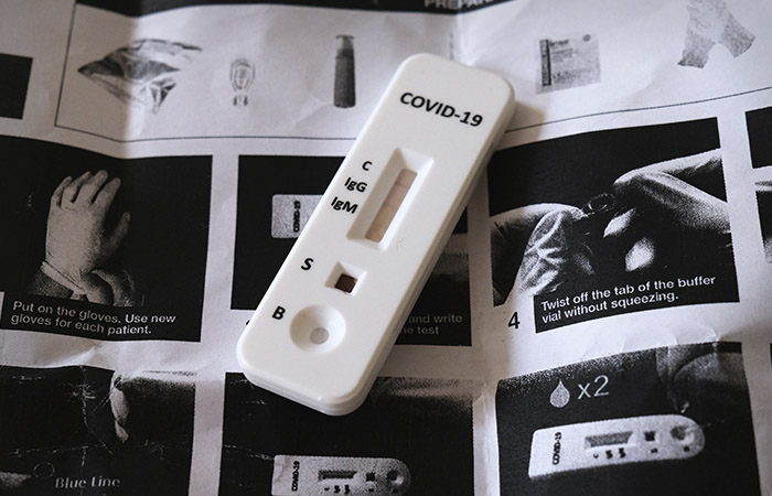 Генпрокурор потребовал проверить подорожание тестов на COVID-19