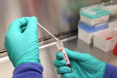 Власти США начали обсуждать вопрос признания оспы обезьян ЧС в здравоохранении