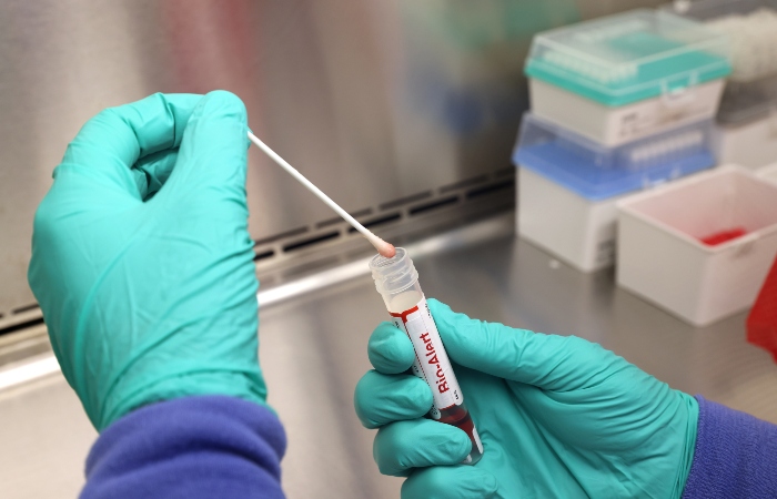 Власти США начали обсуждать вопрос признания оспы обезьян ЧС в здравоохранении