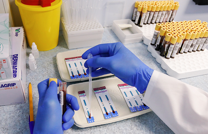 В Минздраве не согласились с данными о 1,5 млн ВИЧ-инфицированных в России