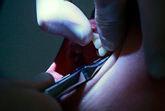 Росздравнадзор не зафиксировал дефицита обезболивающих и медизделий для стоматологии