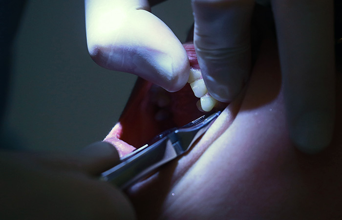 Росздравнадзор не зафиксировал дефицита обезболивающих и медизделий для стоматологии