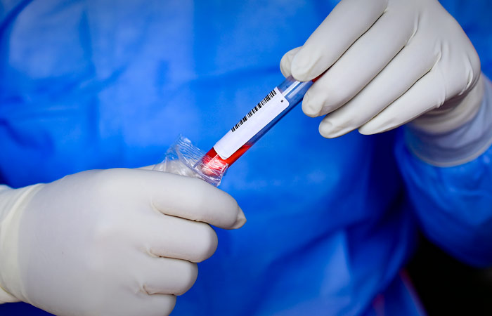 Роспотребнадзор исключил риски завоза чумы из Монголии в РФ