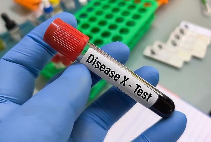 "Болезнь Х": насколько реальна угроза?