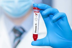 Роспотребнадзор готов противостоять новым инфекциям на фоне разговоров о "болезни Х"