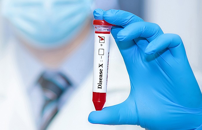 Роспотребнадзор готов противостоять новым инфекциям на фоне разговоров о "болезни Х"