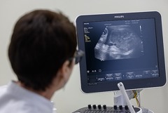 Росздравнадзор заверил, что в РФ достаточно антирезусного иммуноглобулина, необходимого беременным